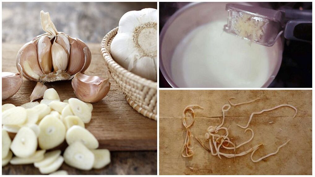 Garlic milk - a folk remedy for worms in children