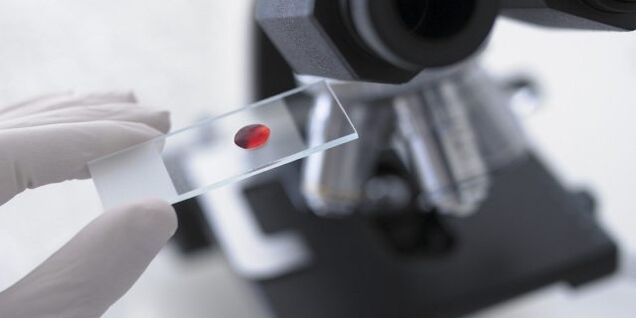 blood test