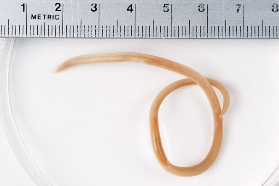 Ascaris is a type of roundworm that lives in the human body.