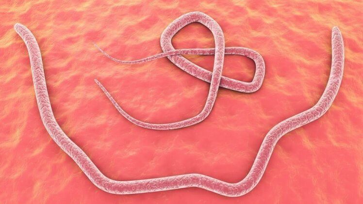 roundworms in human body