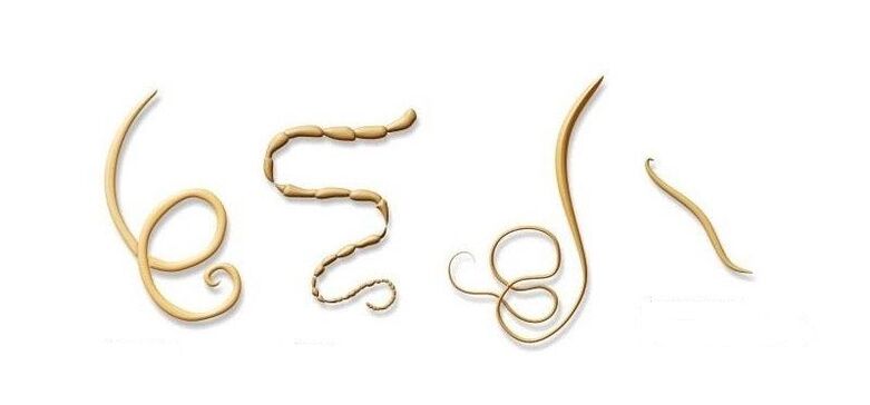 Types of human parasites