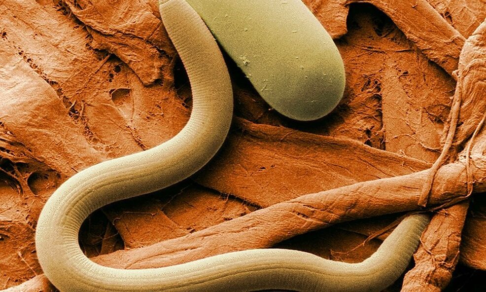 helminth parasites from the human body