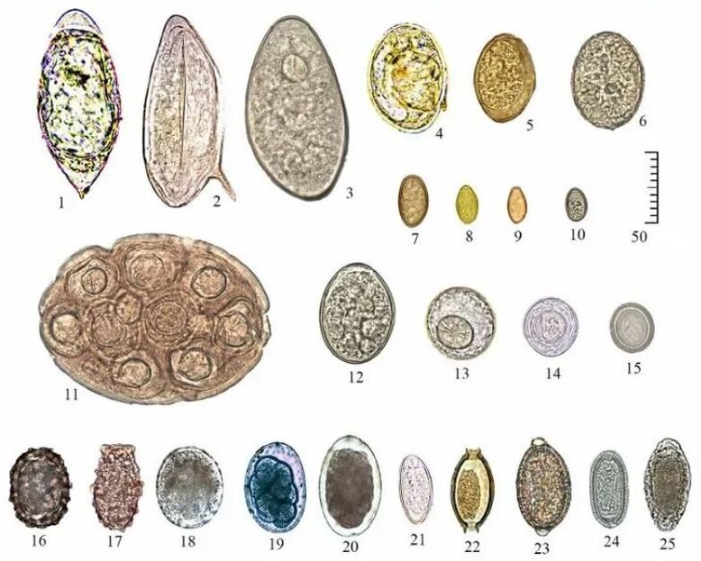 Different worm egg shapes and sizes