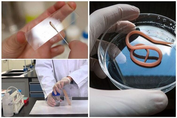 Test for the presence of worms in the body