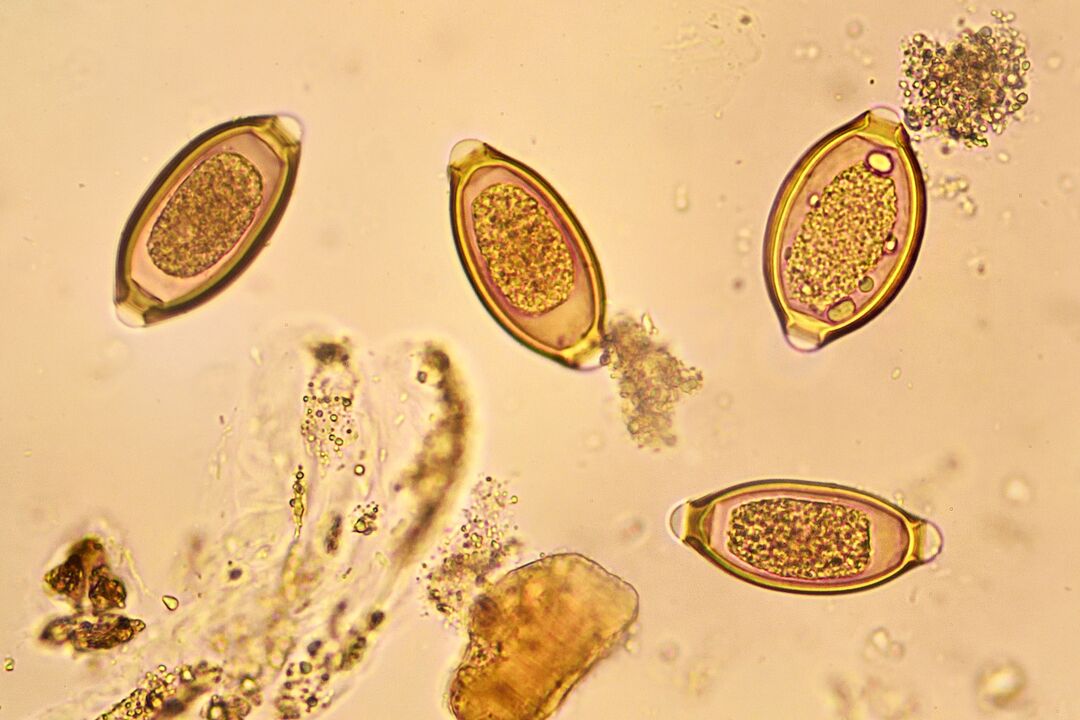worms in human body