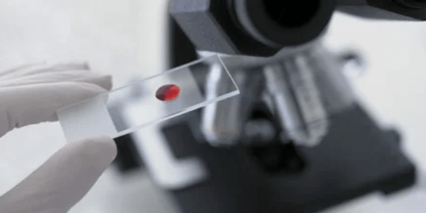 blood test