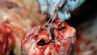 The worm in the heart