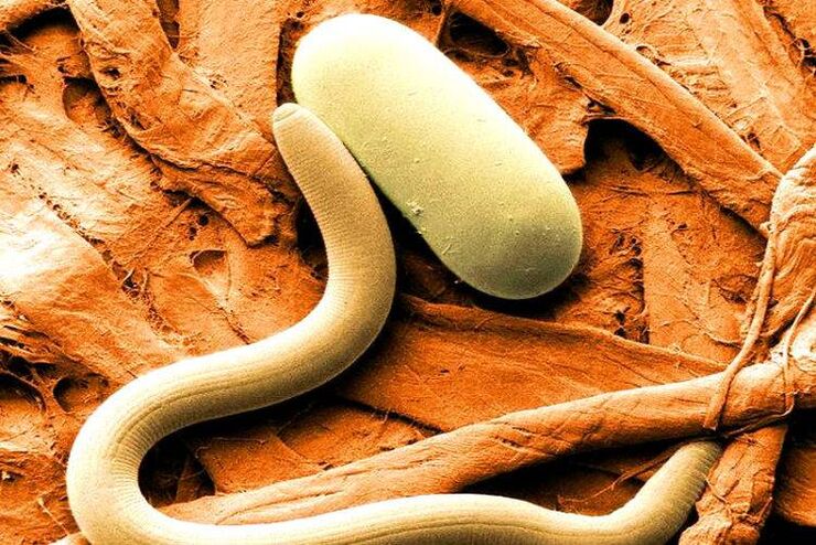 parasites inside human body