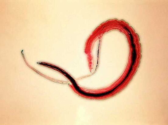Schistosoma