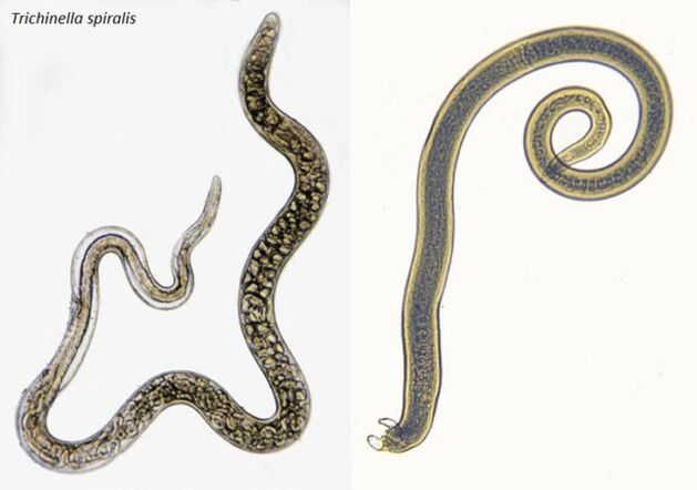 Trichinella spiralis