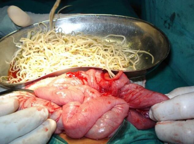 intestinal parasites