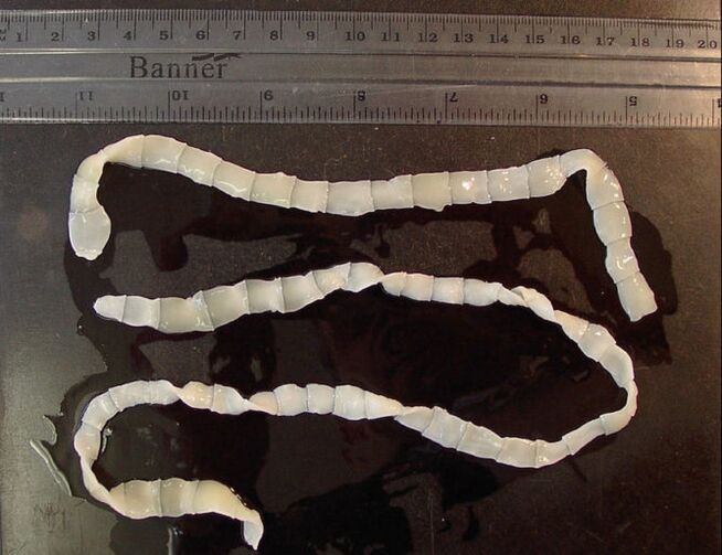 tapeworm